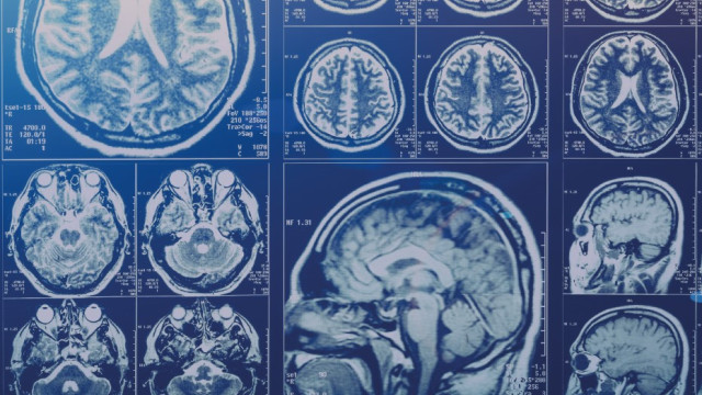Immagini di radiografie craniche