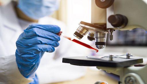 microscopio che analizza un vetrino