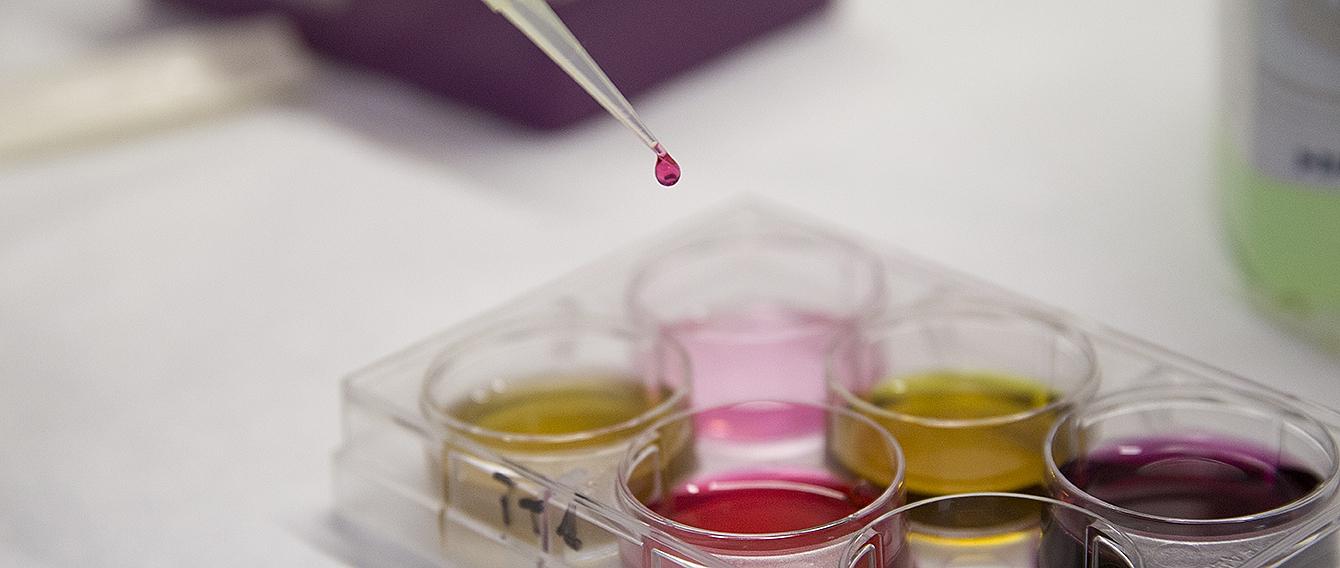 Provetta e vetrini da laboratorio