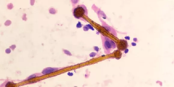 Titolo dell'evento su sfondo colorato, amianto al microscopio